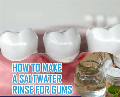 8 Steps To Make A Saltwater Rinse For Gums (Dental Care)