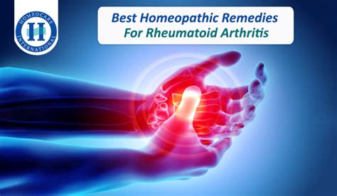 Best Homeopathic Remedies for Rheumatoid Arthritis | Homeocare International