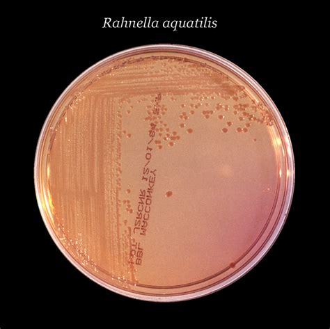 Public Domain Picture | After 24 hours, this inoculated MacConkey agar culture plate cultivated ...