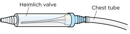 Caring for Your Chest Tube and Heimlich Valve | Memorial Sloan Kettering Cancer Center