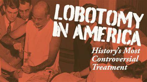 Lobotomy in America: Walter Freeman and the History's Most Controversial Treatment - YouTube