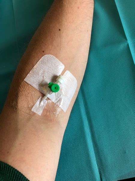 What Is a Cannula? | Cannula Types & Placement | Study.com