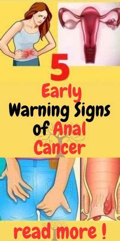 5 Early Warning Signs of Anal Cancer Abnormal Cells, Beauty Tips And Secrets, Bladder Cancer ...