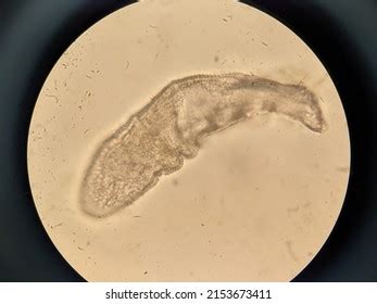 Photo Demodex Face Mites Under Microscope Stock Photo 2153673411 | Shutterstock