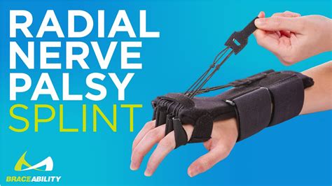 Radial Nerve Palsy Splint | Dynamic Wrist Drop & Finger Extension Brace - YouTube