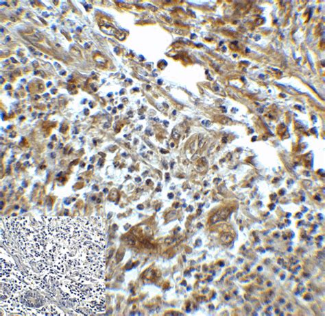 Anti-HAVCR2 / TIM-3 Antibody | Mouse anti-Human Monoclonal | LSBio