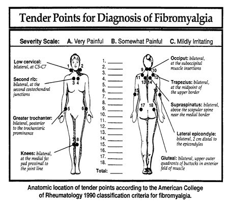 Fibromyalgia Treatment in Houston - Houston Walk In Chiropractic