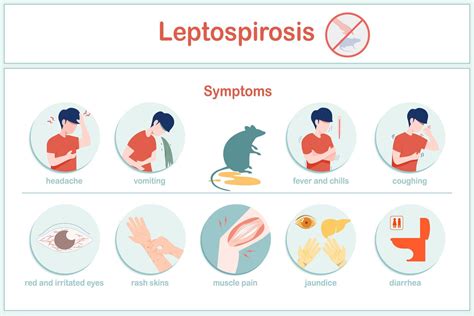 Vector illustrations infographic symptoms of leptospirosis fever ...