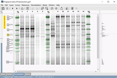 Pulsed-field gel electrophoresis (PFGE) typing | Applied Maths