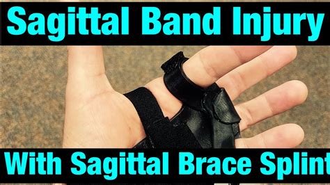 Sagittal Band Injury with Splint - YouTube