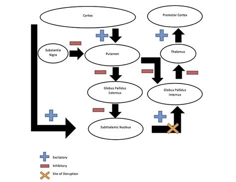 Cureus | Acute Hemiballismus as the Presenting Feature of Parietal Lobe ...