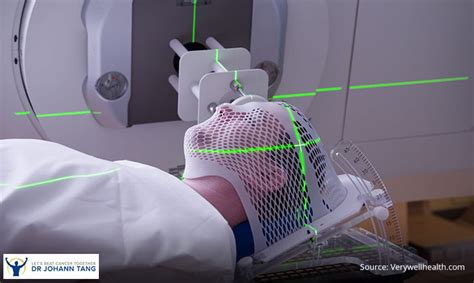 Stereotactic Radiosurgery & Radiotherapy | Dr Johann Tang