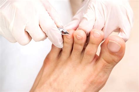 Diabetic Foot Care: Tips for Healthy Feet With Diabetes | Reader's Digest