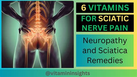 Sciatic Nerve Pain Relief: The Top 6 Essential Vitamins You Need - YouTube