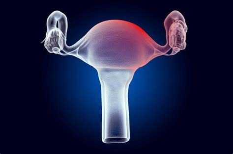 What Could Trigger Enlarged Uterus? 12 Possible Causes - OptingHealth