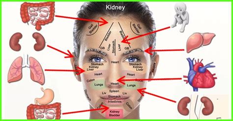 6 Internal Problems The Pimples On Your Face Scream | Natural acne ...