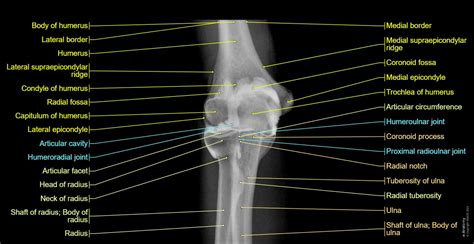 Elbow CT arthrography: normal anatomy | e-Anatomy