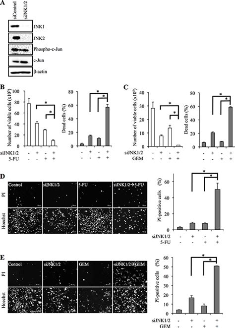 JNK suppression of chemotherapeutic agents-induced ROS confers chemoresistance on pancreatic ...