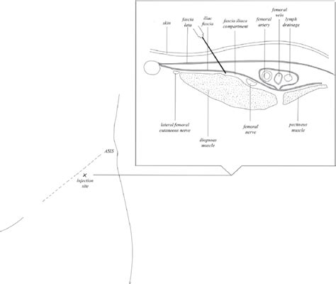 FICB Anatomy. Note: Illustration by Nusha Ramsoondar. Abbreviation:... | Download Scientific Diagram