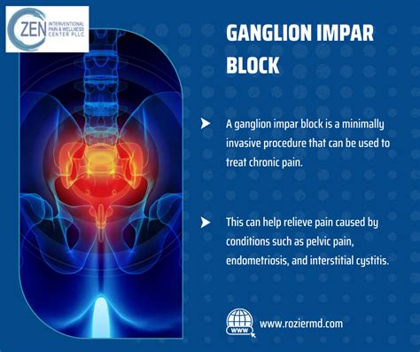 Recognize Ganglion Impar Block Is Right for You In Mansfield, Tx