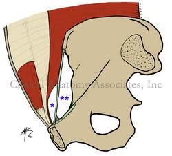 Myopectineal orifice