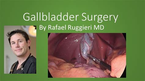 Gallbladder Surgery Video - YouTube