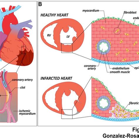 The zebrafish heart: anatomy, histology and injury paradigms. (A ...