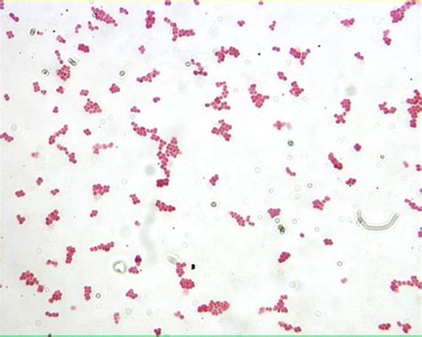 Cocci Bacteria Under Microscope