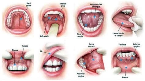 Mouth Cancer Causes | Anderson Lake Dental