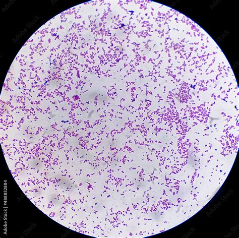 Escherichia coli bacterium, E.coli, gram-negative rod-shaped bacteria. 40x, obrazy, fototapety ...