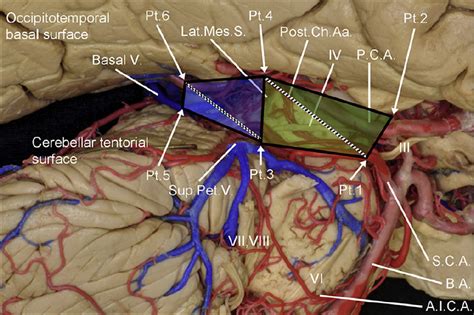 Ambient Cistern | The Neurosurgical Atlas