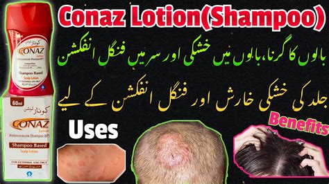 Conaz Lotion Shampoo ||Benefits || Uses || Atco Pharma||Anti Fungal @ChMedicinePoint - YouTube