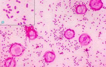 Bacteroides fragilis