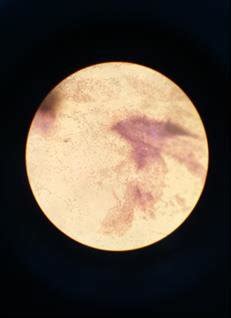 Formation of Lactobacillus under microscope after 14 days of... | Download Scientific Diagram