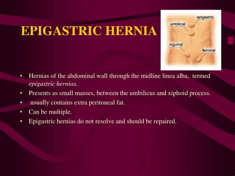 Epigastric Hernia Types