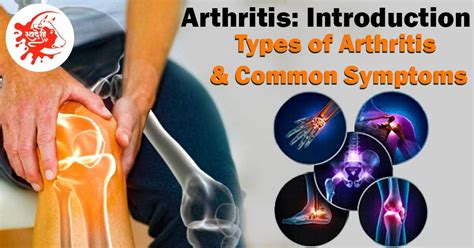 Arthritis: Introduction, Types of Arthritis & Common Symptoms