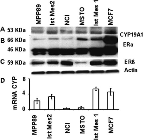 Aromatase and estrogen receptors are expressed in human mesothelioma... | Download Scientific ...