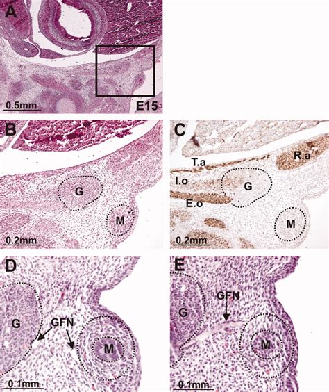 Development of the Gubernaculum During Testicular Descent in the Rat - Nation - 2011 - The ...