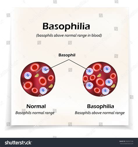 Basophils Above Normal Range Blood Basophilia Stock Vector (Royalty ...