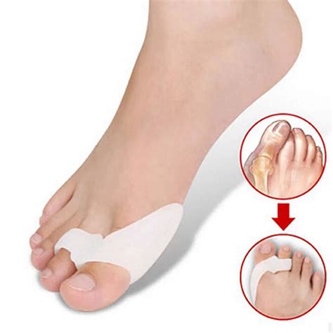 2017 Hallux Rigidus Hallux Valgus Pdf Night Splint Medicus Pro Hallux Valgus For Hammer Toe ...