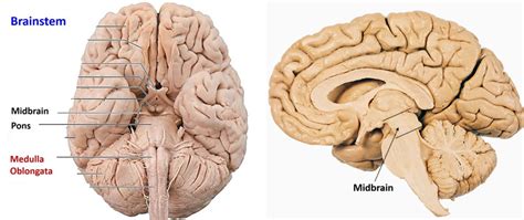 Midbrain Anatomy – Anatomy QA