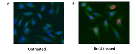 BrdU (Bromodeoxyuridine) for Cell Proliferation Analysis | Bio-Rad