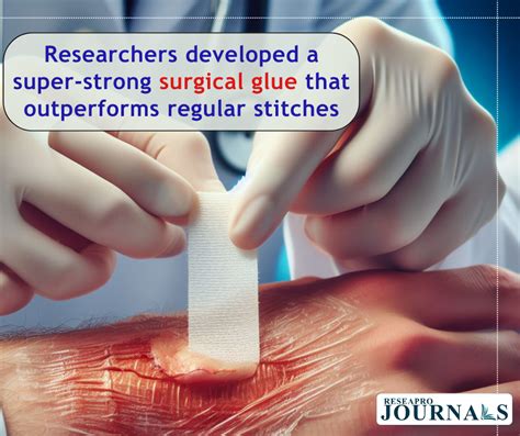 Researchers developed a super-strong surgical glue that outperforms regular stitches