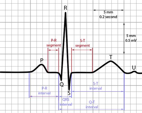 Understanding the PR Interval: A Key to AV Conduction Time