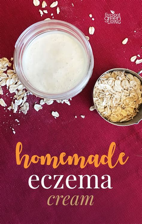 Homemade Eczema Cream Recipe for Dry Winter Skin - Five Spot Green Living