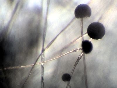 Microscopic pictures of tempeh molds.