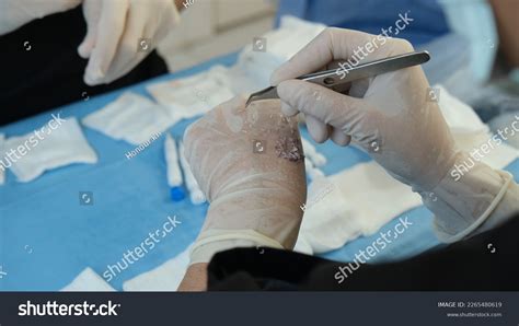 Teamwork Doctors During Surgery Doctors During Stock Photo 2265480619 ...