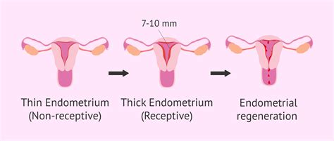 Uterine receptivity as a cause of sterility and solutions