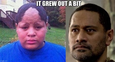 Bad Hairline Memes - Knockin Jokes