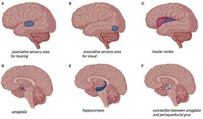 Frontiers | Temporal Lobe Epilepsy and Psychiatric Comorbidity